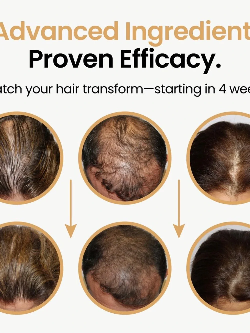 Vitasei hair booster